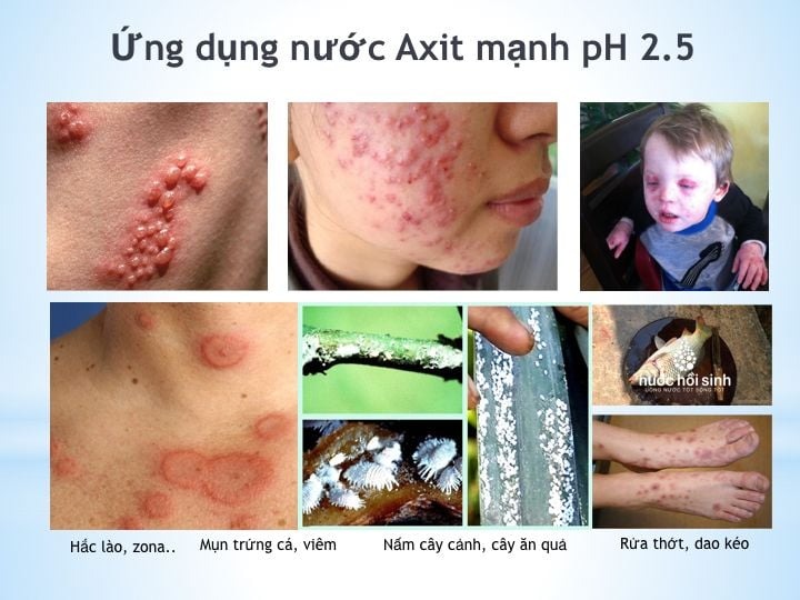 Công dụng của nước axit pH 2.5-5.5: Làm đẹp da, sát khuẩn nhẹ nhàng