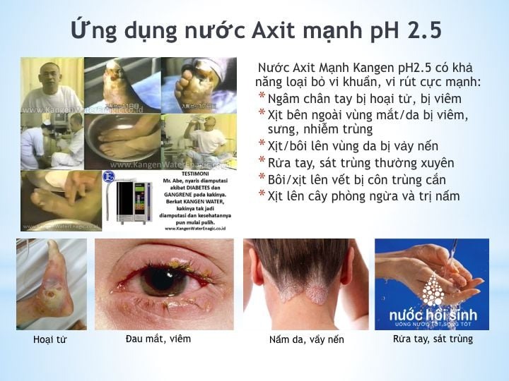 Công dụng của nước axit pH 2.5-5.5: Làm đẹp da, sát khuẩn nhẹ nhàng